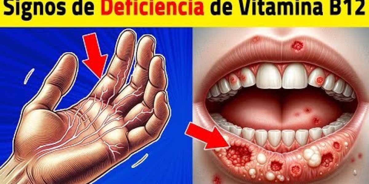 Déficit de vitamina B12 y sus diversas manifestaciones dermatológicas