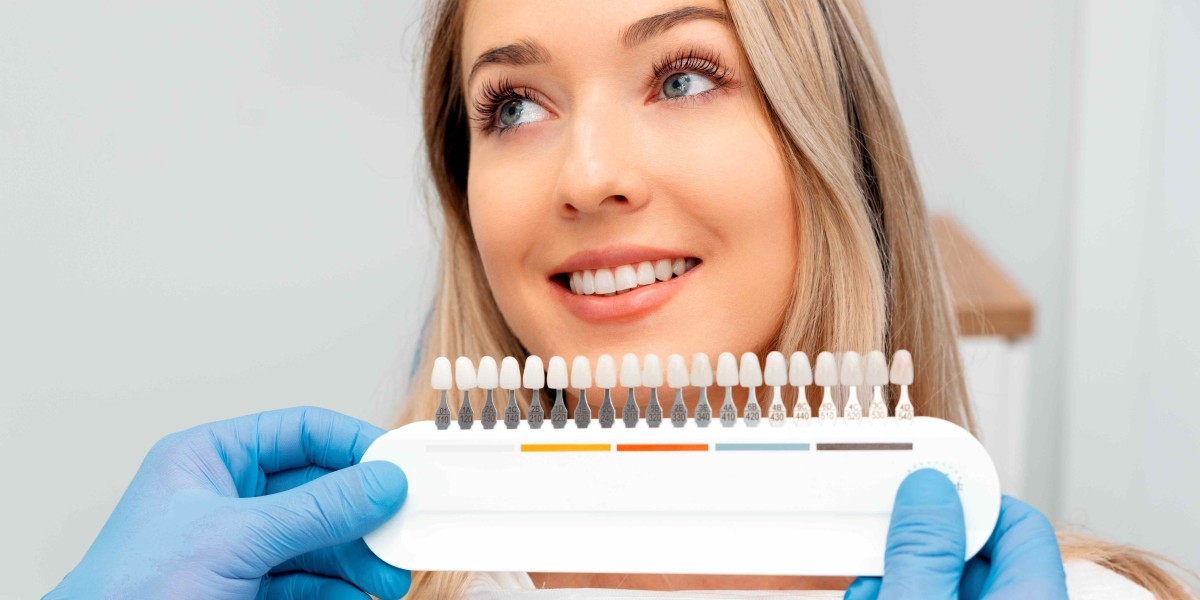 Teeth Whitening for Men: Why More Guys Are Choosing Brighter Smiles