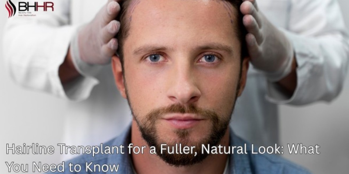 Hairline Transplant for a Fuller, Natural Look: What You Need to Know