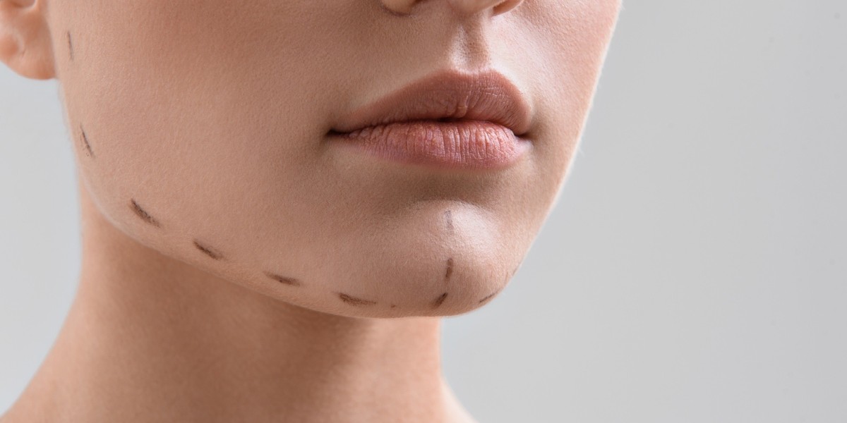 Sculpted Jawlines with Expert Fillers