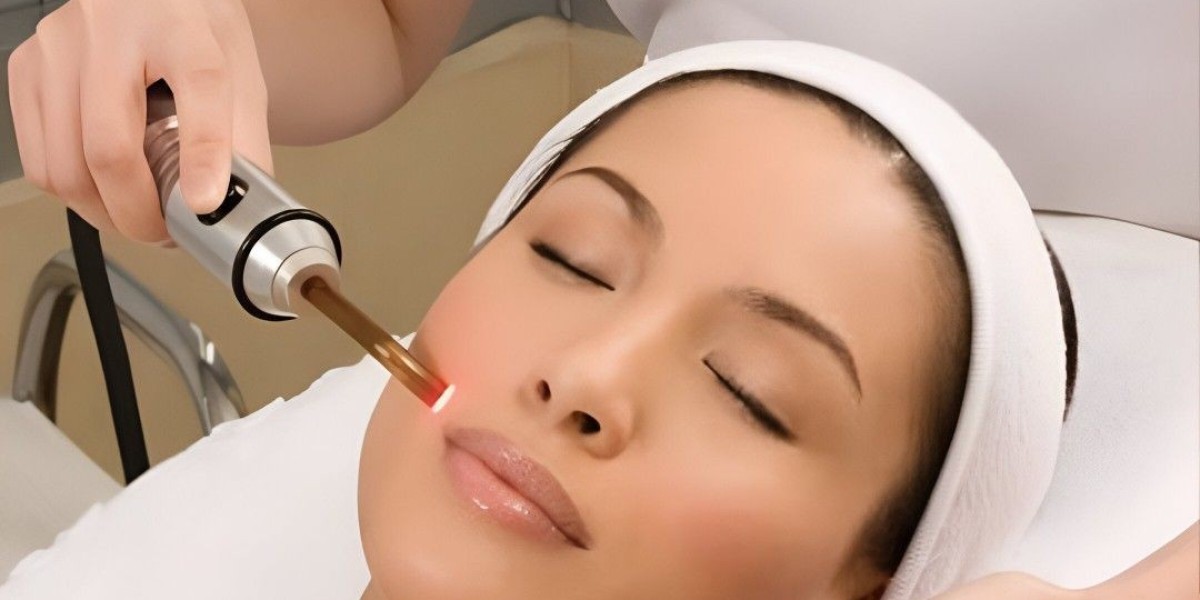 Your Complete Guide to Chemical Peel Treatment in Islamabad