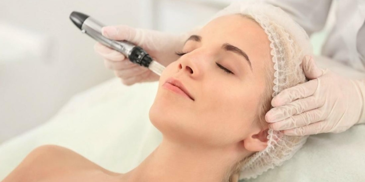 Transform Your Skin Naturally with Advanced PRP Microneedling in Islamabad