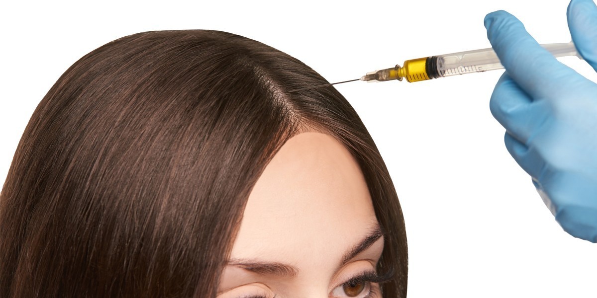 Advanced Hair Restoration with Exosomes for Hair Loss in Islamabad