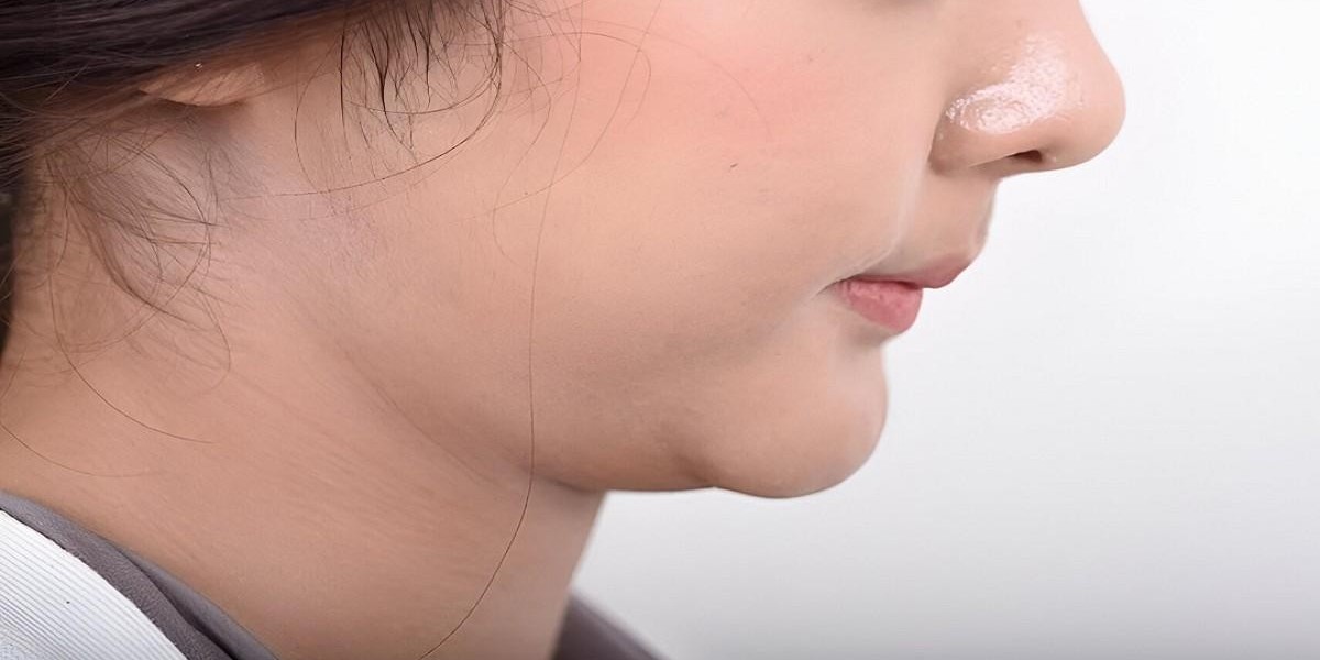 Double Chin Liposuction in Islamabad for Jaw Precision